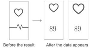 FIG 14 Mode fréquence cardiaque